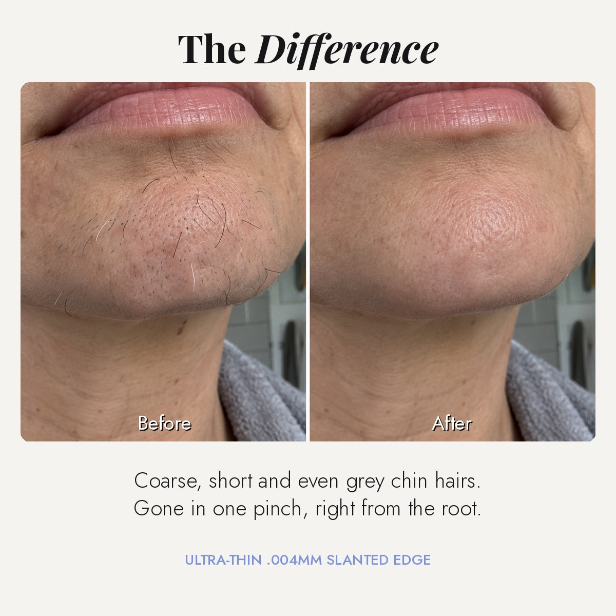 Before and after chin hair removal with Luxara tweezers