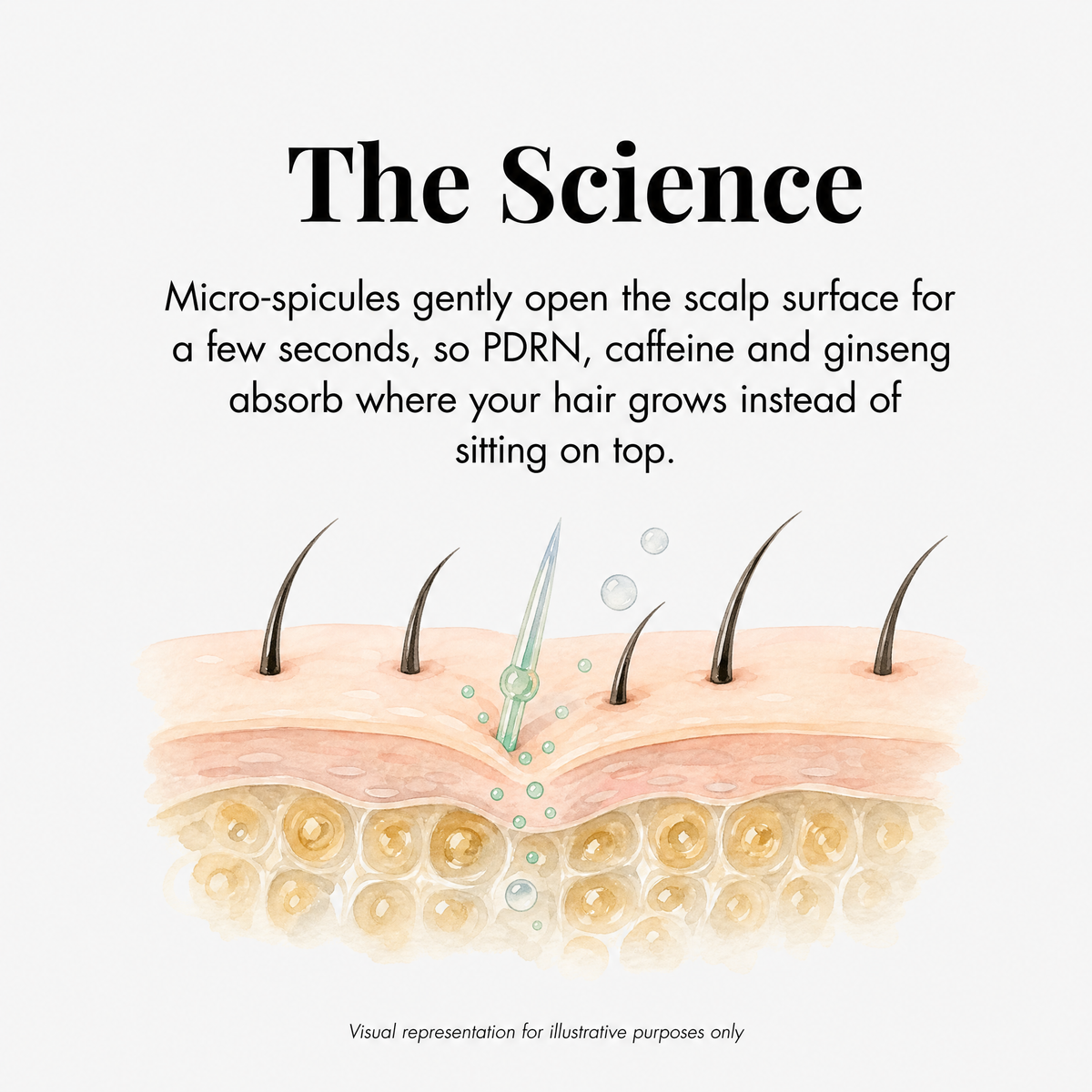 How micro-spicules work, illustrative