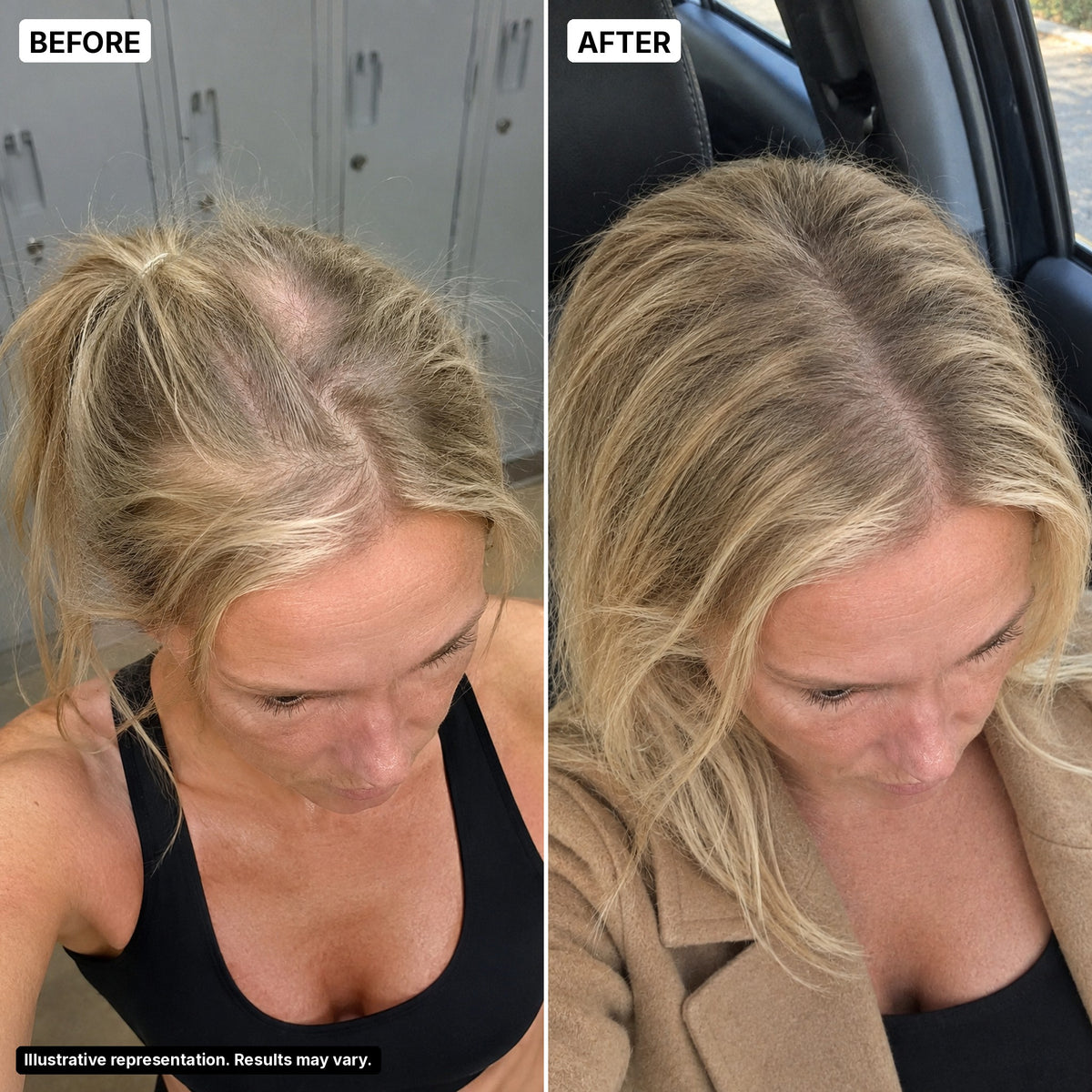 Before and after – crown, woman 40, illustrative representation