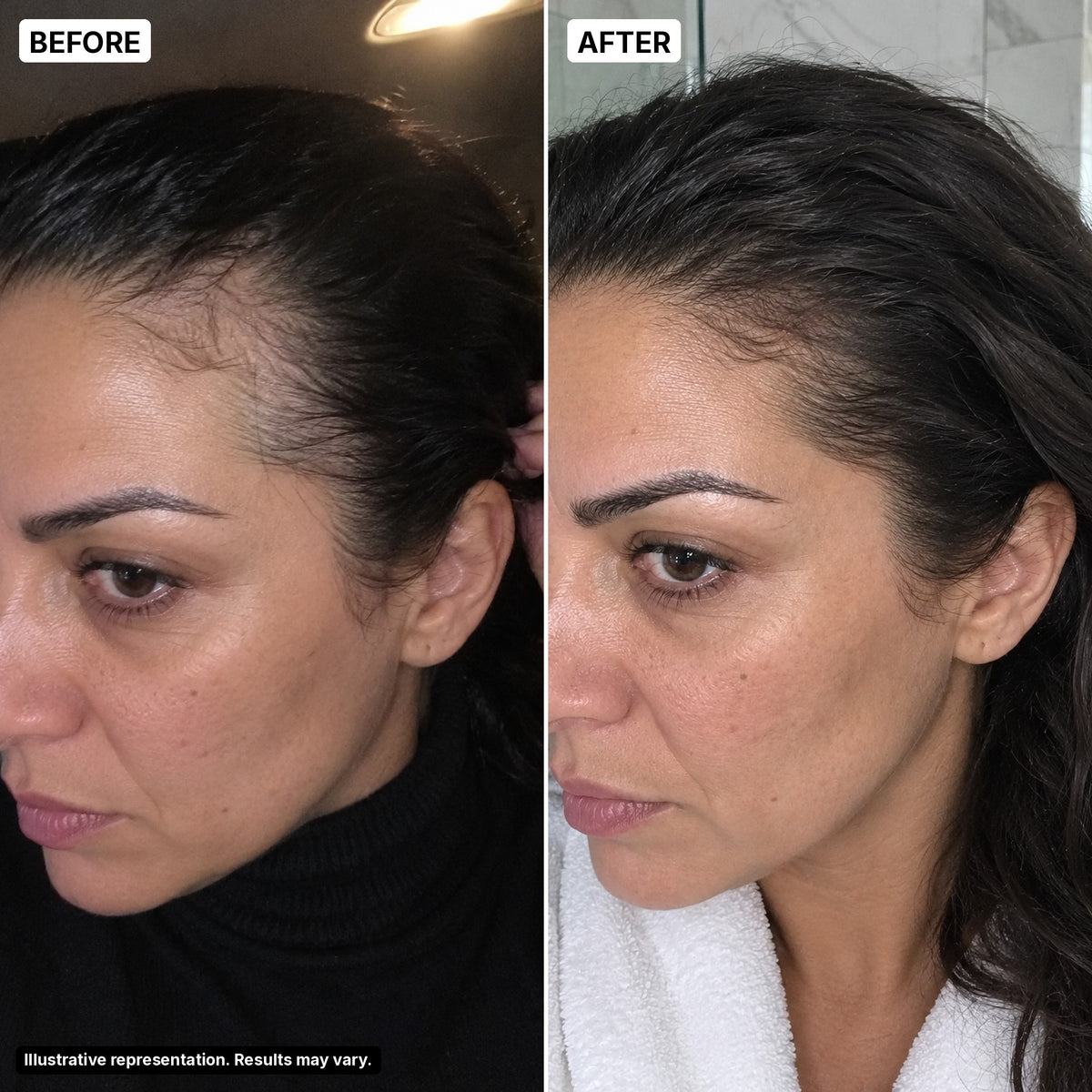 Before and after – temple, woman 45, illustrative representation