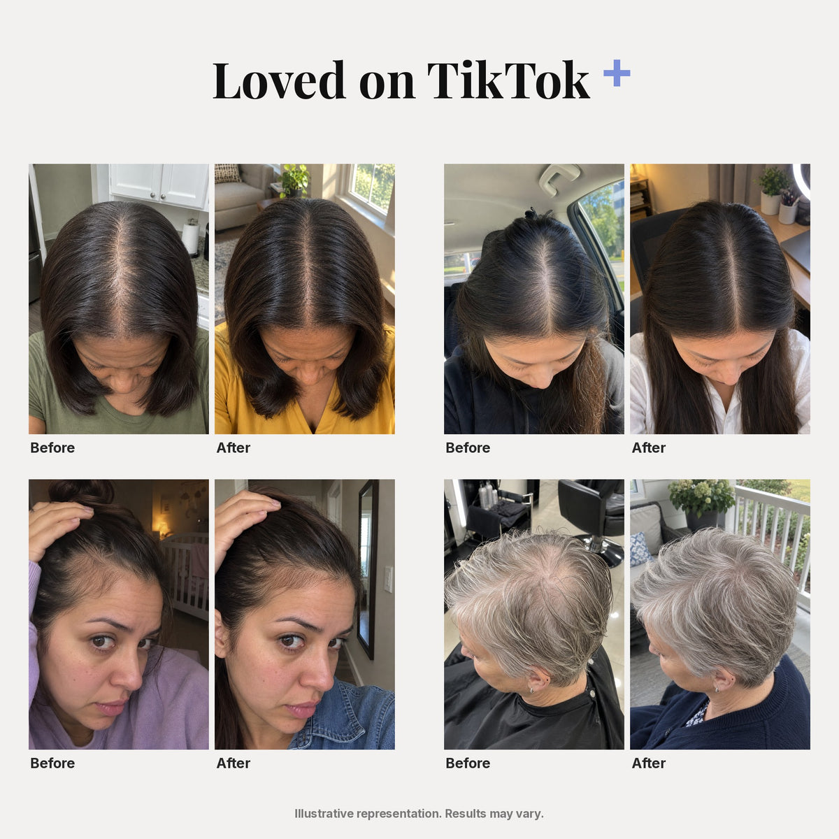 Loved on TikTok grid – 4 women, before/after of part and hairline, illustrative representation