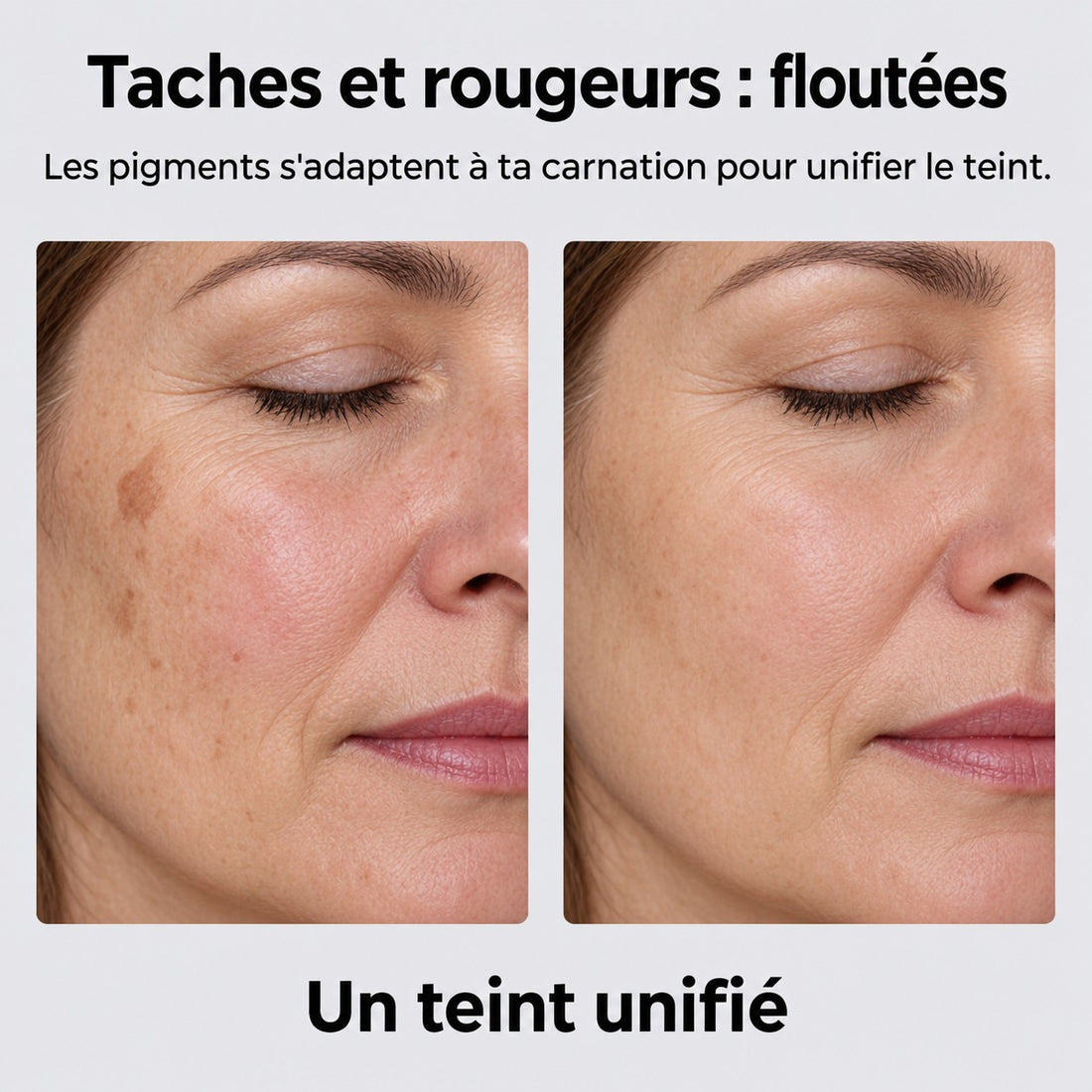 Floute taches et vieilles cicatrices